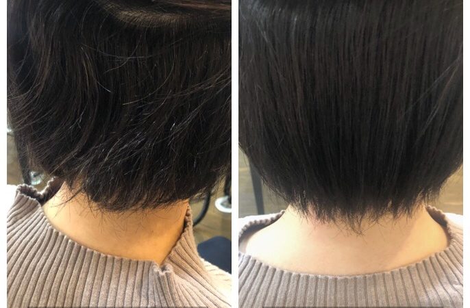 矯正は魔法ではありません。